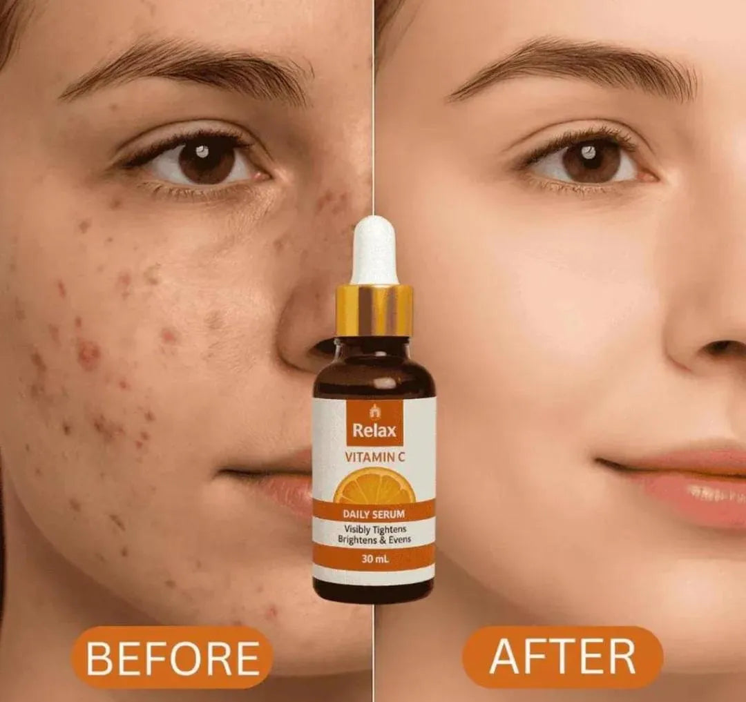 Relax Vitamin C Daily Serum - Skin Brightening & Tightening Formula