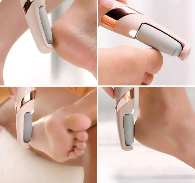 callus remover rechargeable