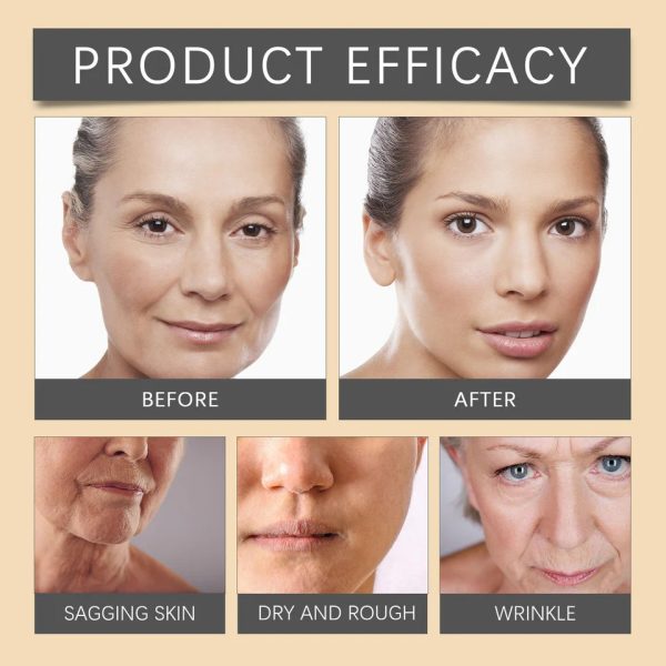 Whitening & Moisturizing Bee Venom Facial Care Cream